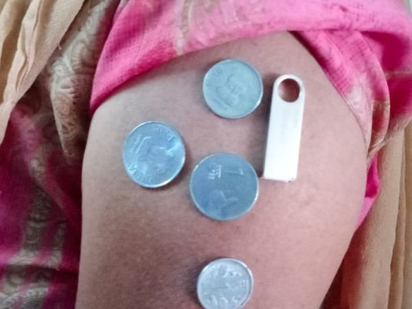 राजस्थान : कोटा में महिला और पुरुष का दावा- टीका लगवाने के बाद शरीर हुआ चुम्बक, चिपकने लगे लोहे के सामान, डॉक्टर भी हैरान 