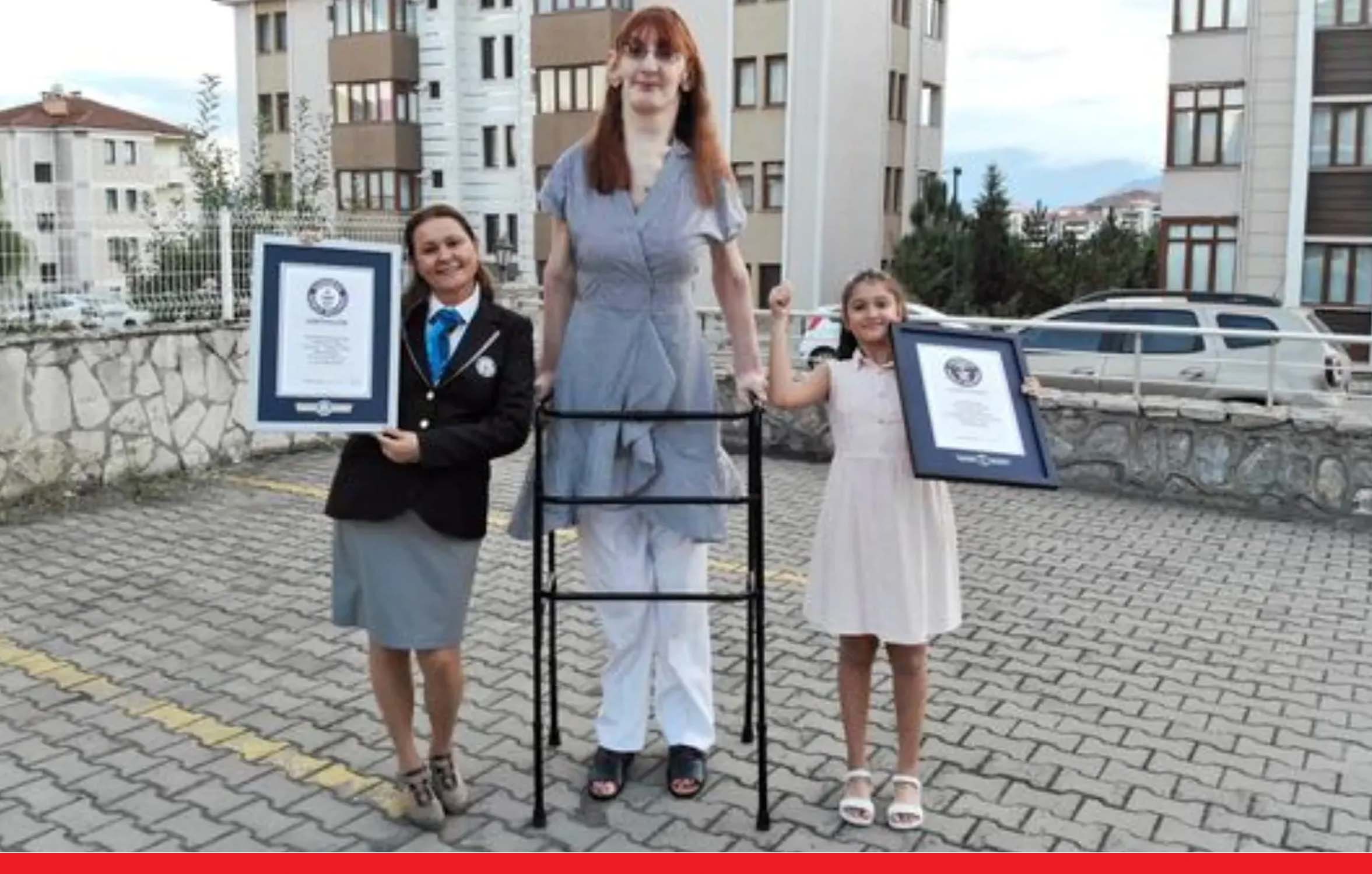 ये है दुनिया की सबसे लंबी महिला, बीमारी के कारण बढ़ रही लंबाई