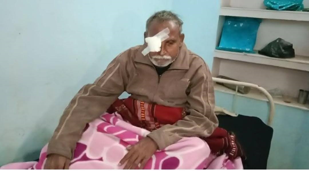 बिहार में डॉक्टरों की लापरवाही के कारण लगभग 20 से ज्यादा लोगों की आंखें निकालनी पड़ी