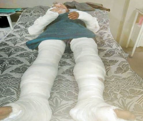 जबलपुर में मटर बेचकर घर लौट रहे किसान को बंधक बनाकर तोड़ दिए दोनों पैर..!