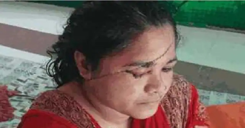 भोपाल में छेडख़ानी का विरोध करने पर महिला पर ब्लेड से हमला, चेहरे पर आये 118 टांके