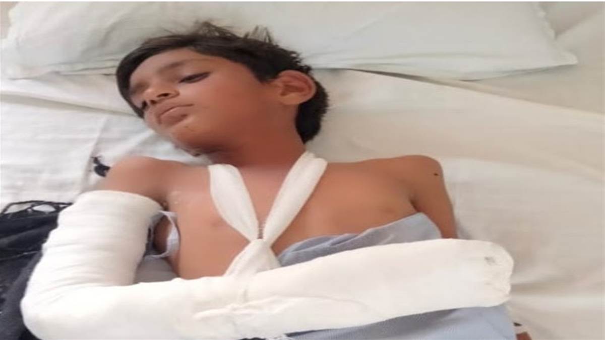 राजस्थान: 10 साल के बच्चे के हाथ में ब्लास्ट हुई मोबाइल की बैटरी, गंभीर, काटनी पड़ी हथेली