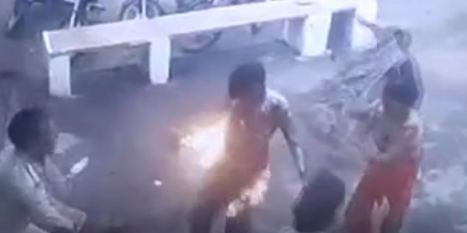 थाना परिसर में किसान ने स्वयं पर पेट्रोल डालकर लगाई आग, पुलिस नही कर रही थी शिकायत पर कार्यवाही