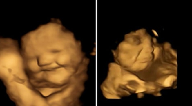 मां के गाजर खाने से खिल उठता है गर्भ में मौजूद बच्चे का चेहरा, वैज्ञानिकों के शोध में हुआ खुलासा