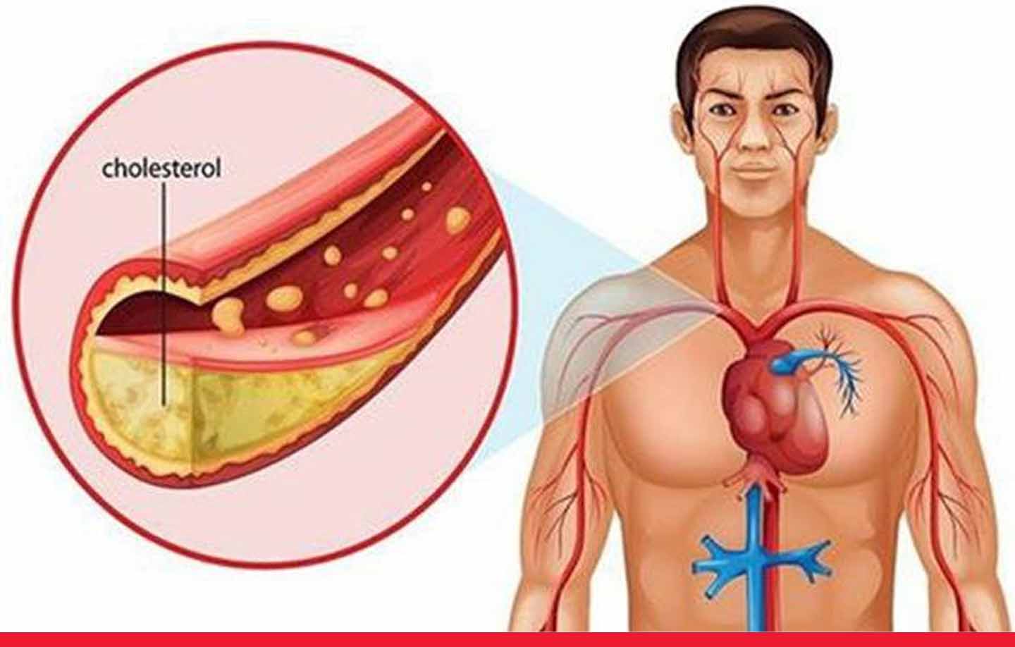 Cholesterol Guidelines: 100 mg/dl से अधिक कोलेस्ट्रॉल अब खतरे की घंटी