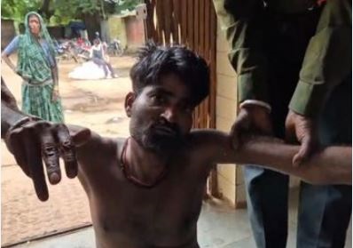 MP : दमोह में पत्नी के मायके जाने से नाराज पति ने काट लिया अपना प्राइवेट पार्ट, हालत गंभीर..!