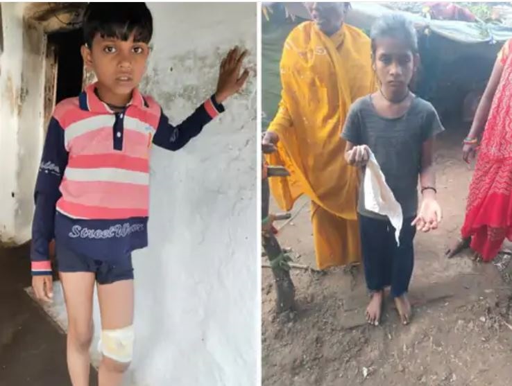 MP : नरसिंहपुर में आवारा कुत्ते ने 12 बच्चों को काटा, 3 साल की बच्ची की हालत नाजुक 