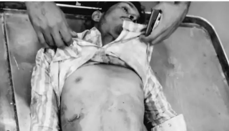 एमपी: कटनी में गणेश पंडाल में तैयारी कर रहे युवक की नृशंस हत्या