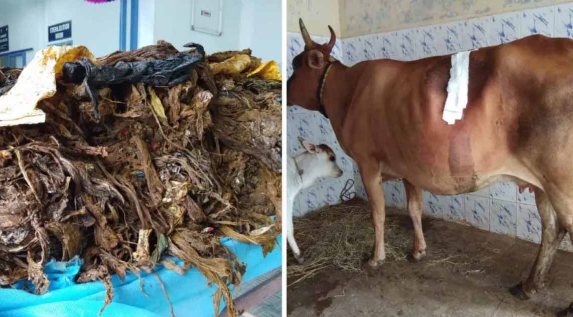 OMG: पेट से निकला 28 किलो प्लास्टिक और 41 कीलें, सर्जरी में डॉक्टरों के भी उड़े होश