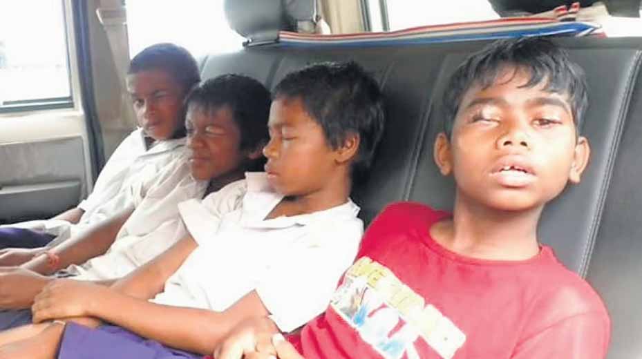 ओएमजी: चौथी-पांचवीं छात्रों के 8 बच्चों की आंखों में डाला फेवीक्विक, अस्पताल में भर्ती