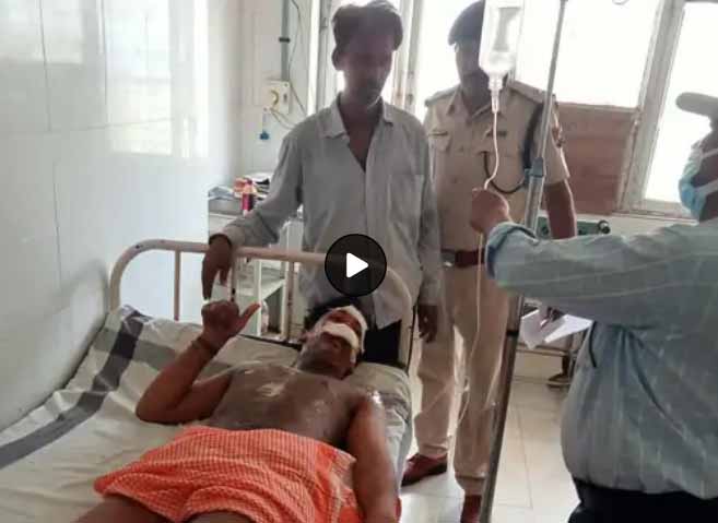 सतना में सेल्फी लेने मालगाड़ी की छत पर चढ़ा किशोर, लगा करंट का झटका, हालत गंभीर