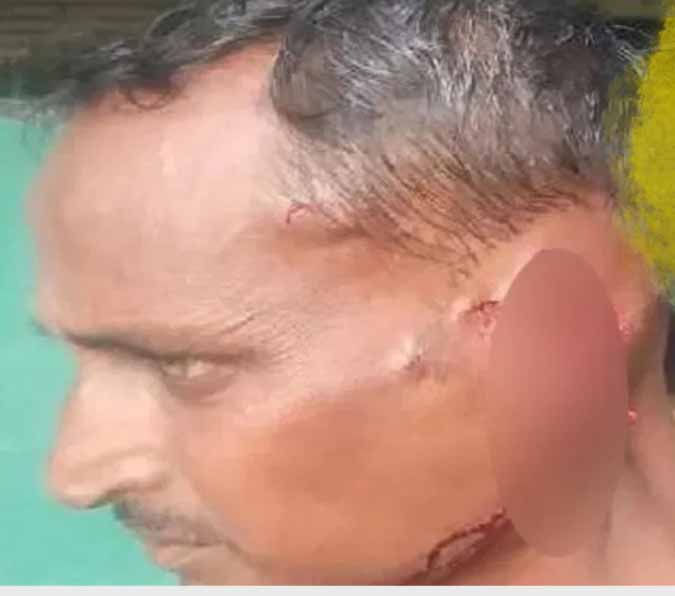 बंदरों की गैंग का कारनामा, किसान का कान ही काट कर ले गये, गंभीर, अस्पताल में भर्ती
