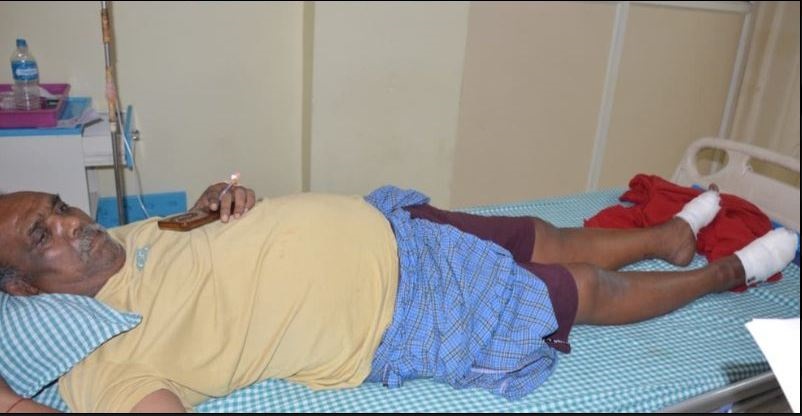 जबलपुर में पति-पत्नी के बीच झगड़ा सुलझाने पहुंचे पिता को लगी गोली, दोनों पैर में लगे छर्रे