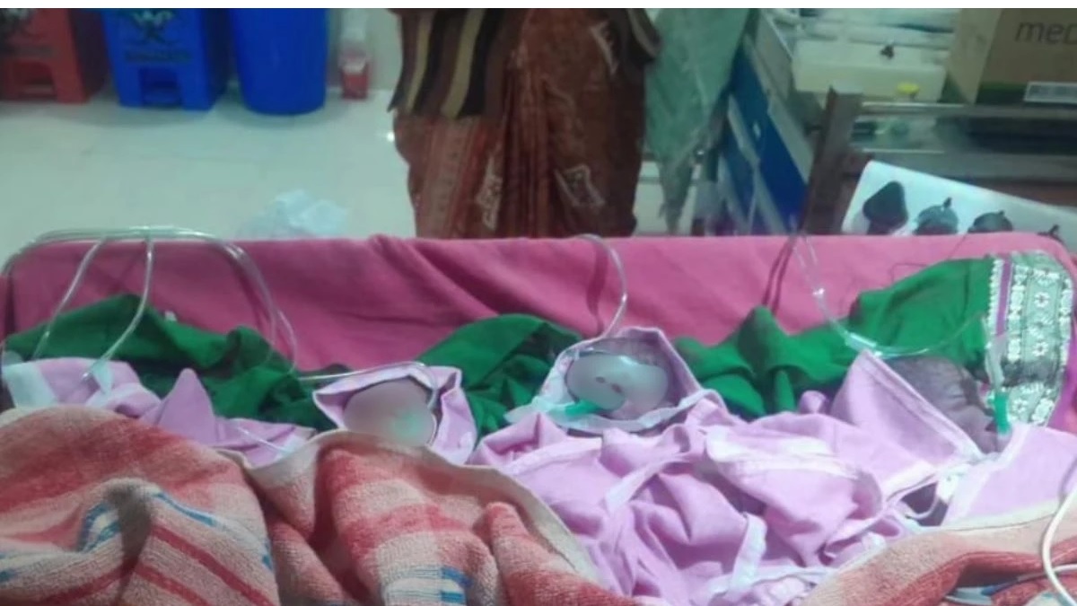 एमपी के छिंदवाड़ा में महिला ने एक साथ चार बच्चों को दिया जन्म, बेटे की हालत गंभीर