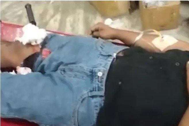 जबलपुर में श्रीराम कॉलेज में दो छात्रों के बीच टकराव, पैर में फंसा चाकू लेकर पहुंचा अस्पताल युवक, देर रात तक चलती रही सर्जरी