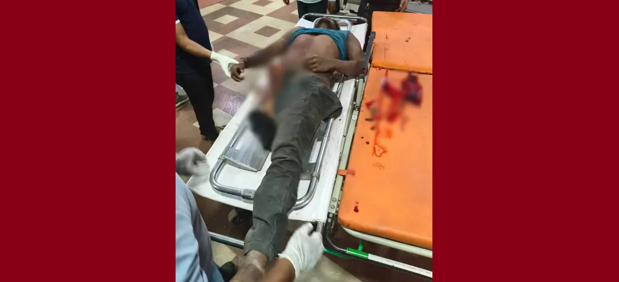 छत्तीसगढ़: बालोद में कार के कुचलने से 3 दोस्तों की मौत, एक का कटा पैर 50 मीटर दूर मिला