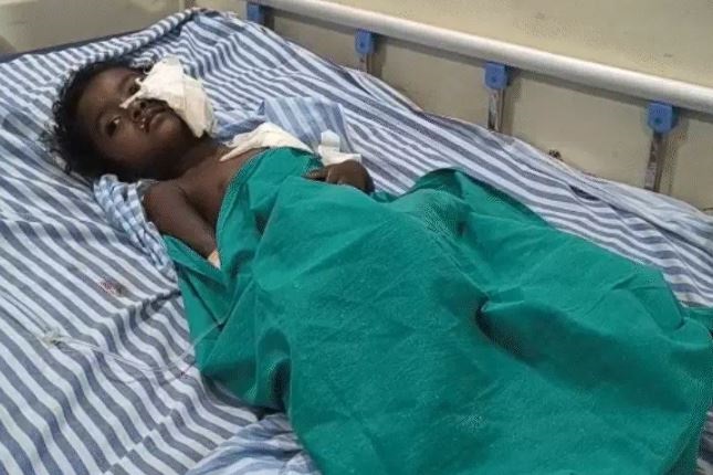 जबलपुर में सगी बहनों को आवारा कुत्ते ने नोचा, मां ने एक बेटी को बचाया तो दूसरी को मुंह में दबा लिया