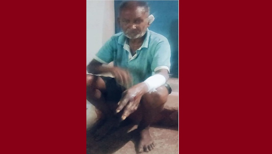 जबलपुर में 15 मिनट तक स्ट्रीट डॉग से लड़ा वृद्ध, पूरे शरीर में आई चोट, चौहानी क्षेत्र गढ़ा में घटना