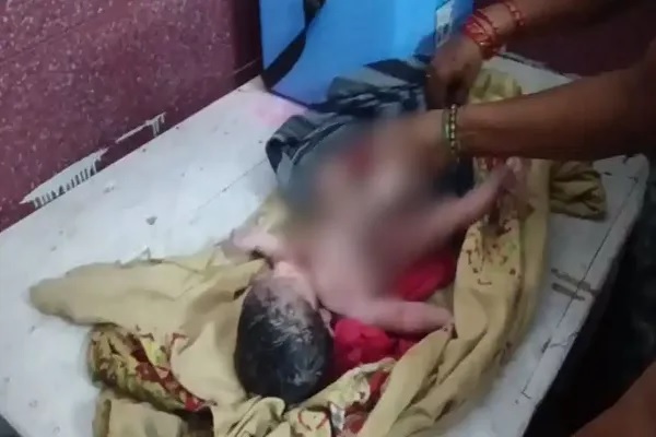 4 हाथ और 4 पैर के साथ एमपी में जन्मा बच्चा, देखते ही उड़े परिजनों के होश, डॉक्टरों ने बताई वजह