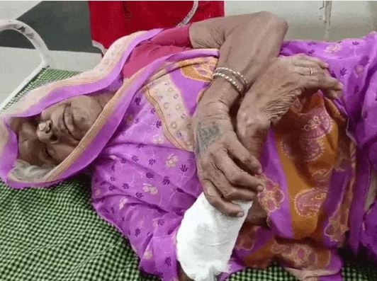 बुजुर्ग महिला पर आवारा कुत्ते ने किया हमला, हाथ-पैर में 12 से ज्यादा घाव, पड़ोसियों ने लाठी-डंडों से भगाया, जबलपुर रेफर