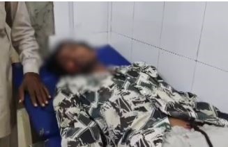 जबलपुर में बदमाशों ने युवक पर सरेराह किया हमला, खून से लथपथ घायल लडख़ड़ाते हुए पहुंचा थाना